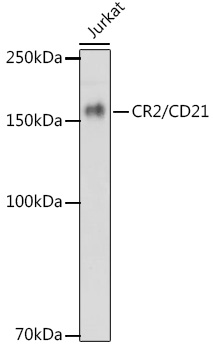 CR2/CD21 Rabbit mAb