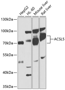 ACSL5 Rabbit pAb