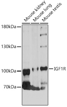 IGF1R Rabbit pAb