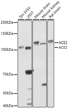 ACE2 Rabbit pAb