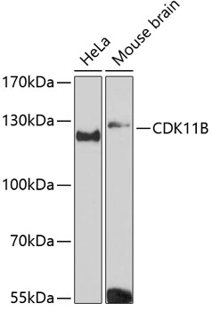 CDK11B Rabbit pAb