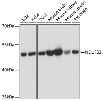 [KO Validated] NDUFS2 Rabbit pAb