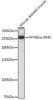 MYH6/_-MHC Rabbit pAb