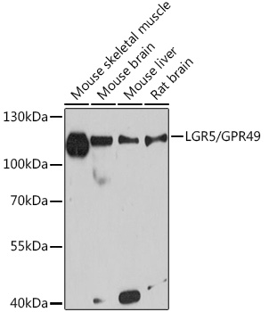 LGR5/GPR49 Rabbit mAb