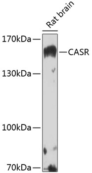 CASR Rabbit pAb