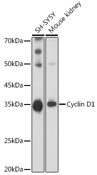 Cyclin D1 Rabbit pAb