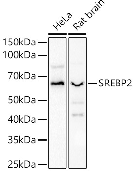 SREBP2 Rabbit pAb