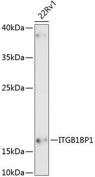 ITGB1BP1 Rabbit pAb
