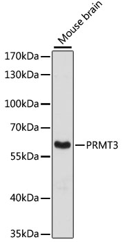 [KO Validated] PRMT3 Rabbit pAb