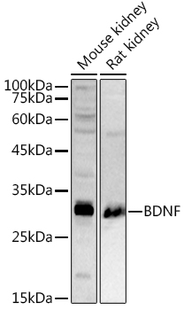 BDNF Rabbit pAb