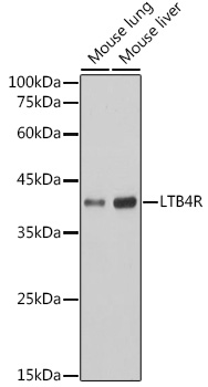 LTB4R Rabbit mAb