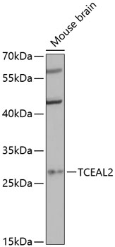 TCEAL2 Rabbit pAb