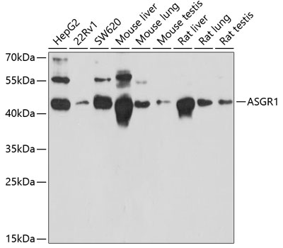 ASGR1 Rabbit pAb
