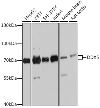 DDX5 Rabbit pAb