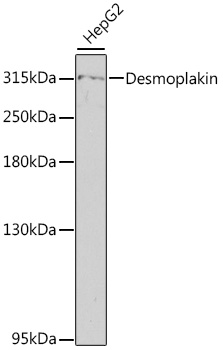 Desmoplakin Rabbit pAb