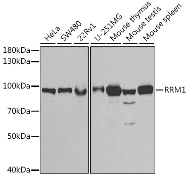RRM1 Rabbit pAb