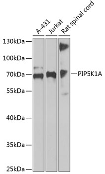PIP5K1A Rabbit pAb