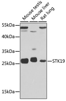 STK19 Rabbit pAb
