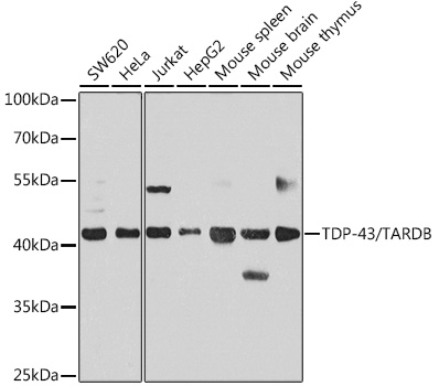 TDP-43/TARDB Rabbit pAb