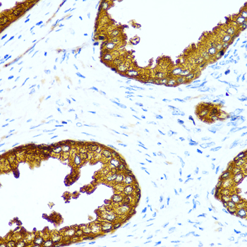 Prostatic Acid Phosphatase (ACPP) Rabbit pAb