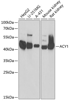 ACY1 Rabbit pAb