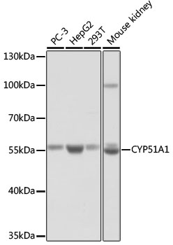 CYP51A1 Rabbit pAb