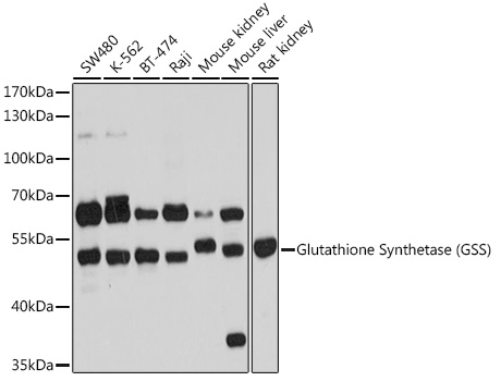 Glutathione Synthetase (GSS) Rabbit pAb