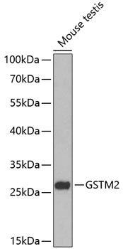 GSTM2 Rabbit pAb