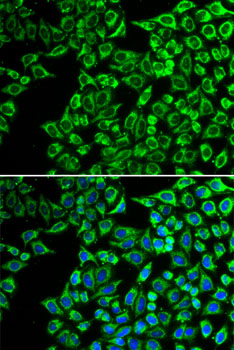 LIPC Rabbit pAb