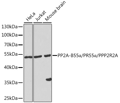 PP2A-B55_/PR55_/PPP2R2A Rabbit pAb