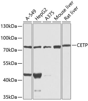 CETP Rabbit pAb