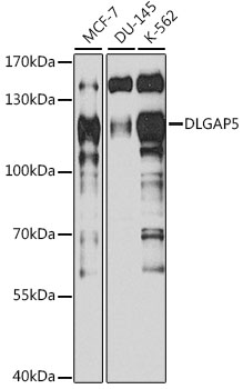 DLGAP5 Rabbit pAb
