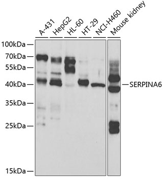 SERPINA6 Rabbit pAb