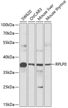 RPLP0 Rabbit pAb