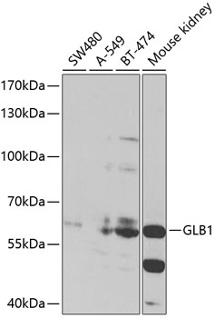 GLB1 Rabbit pAb