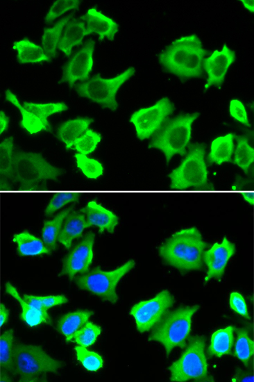 HSP27/HSPB1 Rabbit pAb