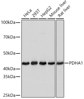 PDHA1 Rabbit mAb