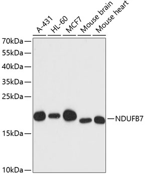 NDUFB7 Rabbit pAb