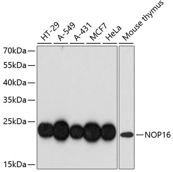 NOP16 Rabbit pAb