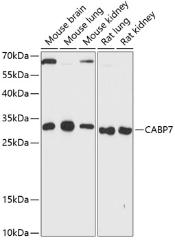 CABP7 Rabbit pAb