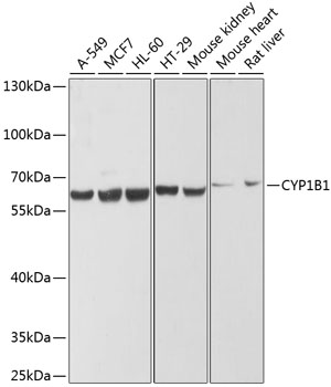 CYP1B1 Rabbit pAb
