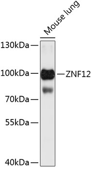 ZNF12 Rabbit pAb