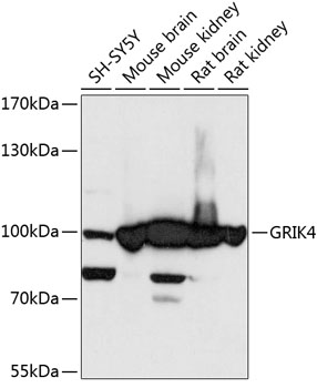 GRIK4 Rabbit pAb