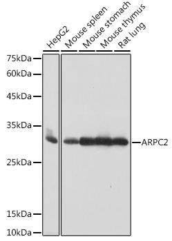 ARPC2 Rabbit mAb