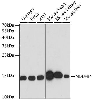 [KO Validated] NDUFB4 Rabbit pAb