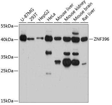 ZNF396 Rabbit pAb