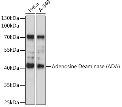 Adenosine Deaminase (ADA) Rabbit pAb