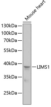 LIMS1 Rabbit pAb