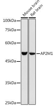 AP2M1 Rabbit pAb