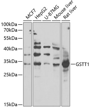 GSTT1 Rabbit pAb